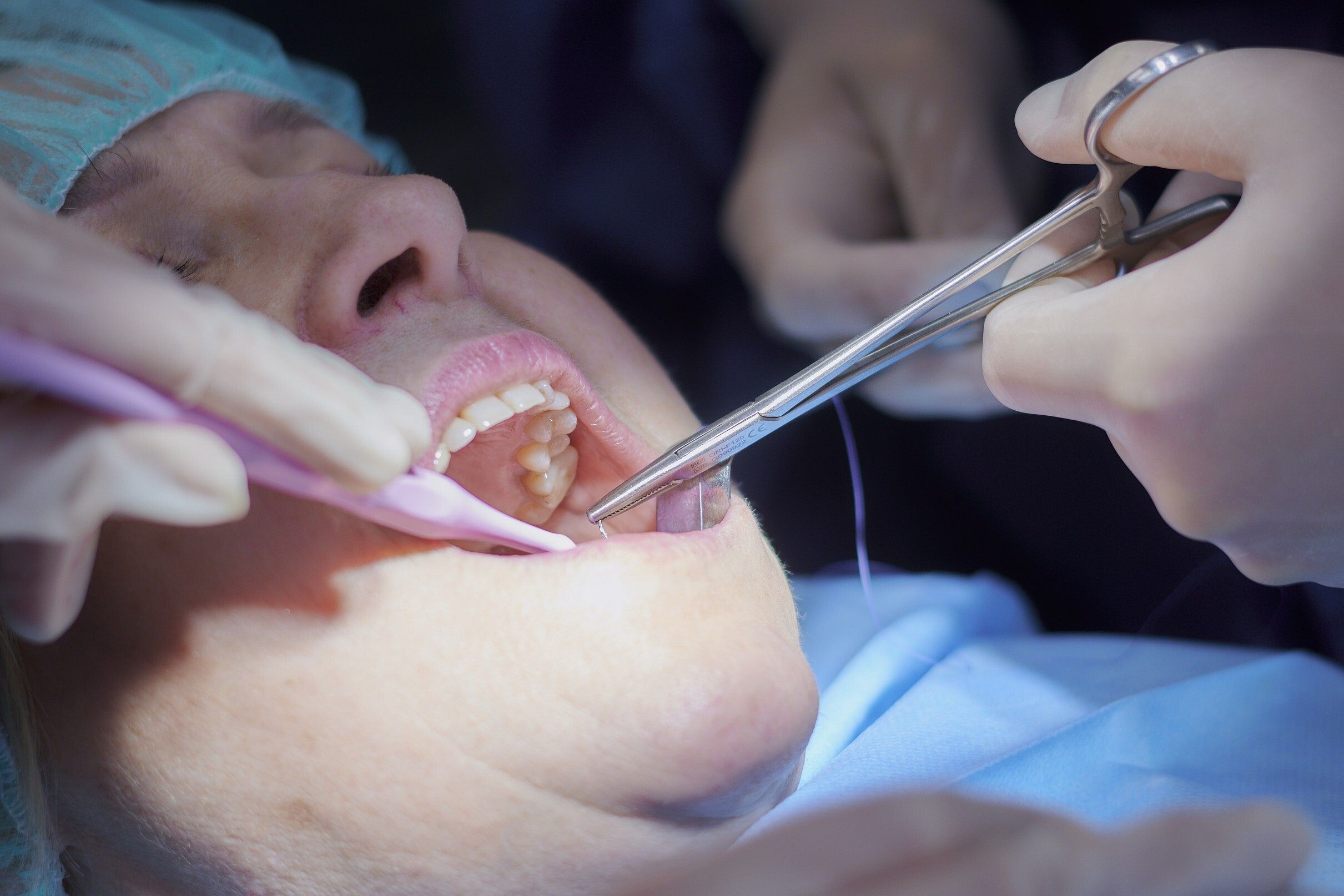 Chirurgia stomatologiczna i implantologiczna w przychodni SALUS, Sobieskiego 30